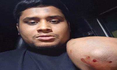 গাজীপুরে হাসনাত আব্দুল্লাহর গাড়িতে হামলা