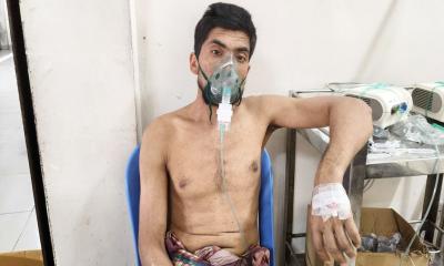 শিশুদের পাশাপাশি বড়রাও আক্রান্ত হচ্ছেন হামে